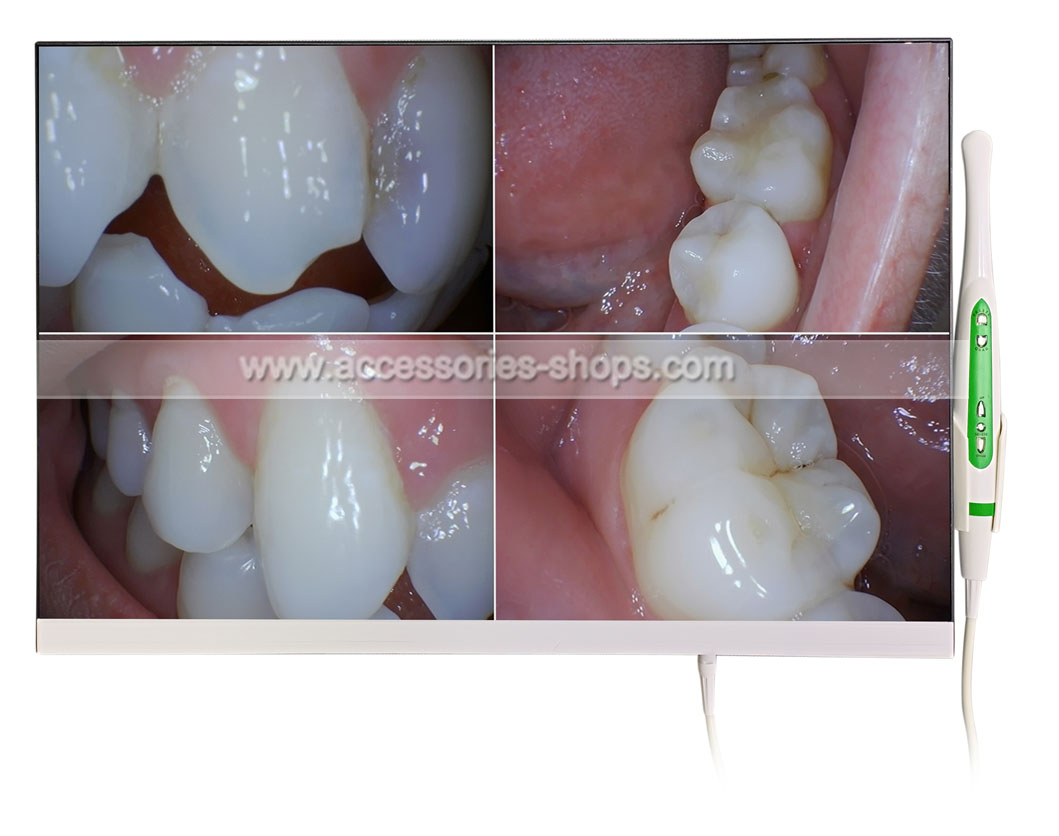 FullHD 1920*1080P 24inch Intraoral Camera System HDMI/VGA Input Oral Camera Dentist Cosmetic Dentistry BEAUTY INSTITUTE